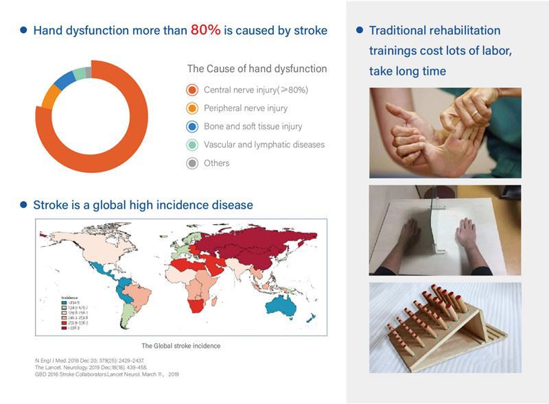 the necessity of the hand rehabilitation after stroke 01